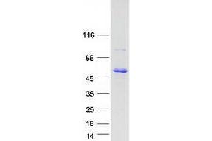 Western Blotting (WB) image for Tuftelin 1 (TUFT1) (Transcript Variant 1) protein (Myc-DYKDDDDK Tag) (ABIN2734593)