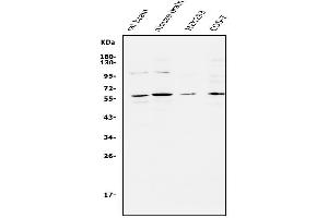 Western blot analysis of APEX2 using anti-APEX2 antibody (ABIN5518737). (APEX2 antibody  (AA 102-210))
