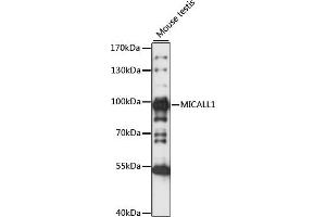 Western blot analysis of extracts of Mouse testis, using MIC antibody (ABIN7268510) at 1:1000 dilution. (MICAL-Like 1 antibody  (AA 614-863))