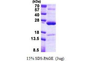 TNFAIP8 Protein (AA 1-198) (His tag)