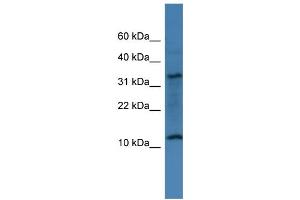 WB Suggested Anti-C14orf177 Antibody Titration: 0. (C14ORF177 antibody  (N-Term))