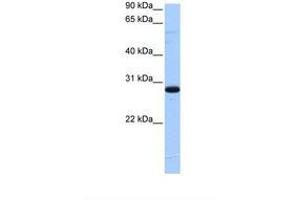 TCEANC2 antibody  (N-Term)