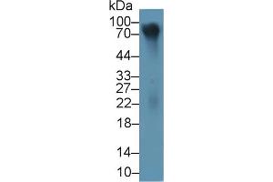 Detection of LUM in Human Cartilage lysate using Polyclonal Antibody to Lumican (LUM) (LUM antibody  (AA 19-338))