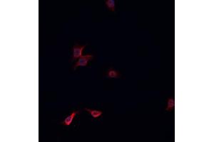 ABIN6268845 staining HeLa cells by IF/ICC. (NRF1 antibody  (Internal Region))