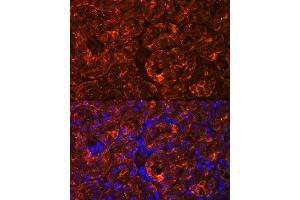 Immunofluorescence analysis of Rat kidney using MIOX Rabbit pAb (ABIN7268729) at dilution of 1:100. (MIOX antibody  (AA 1-285))