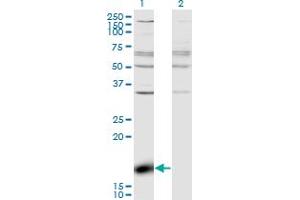 ZBP1 antibody  (AA 2-100)