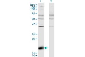 Western Blot analysis of ZBP1 expression in transfected 293T cell line by ZBP1 monoclonal antibody (M01), clone 2C10. (ZBP1 antibody  (AA 2-100))