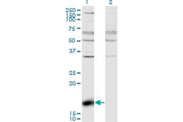 ZBP1 antibody  (AA 2-100)