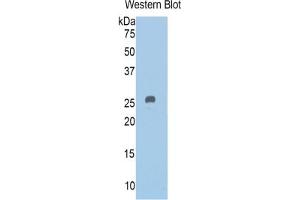 WB of Protein Standard: different control antibodies against Highly purified E.