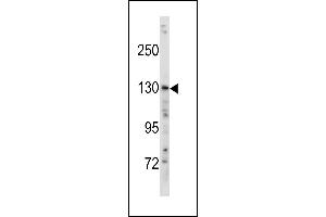 TSC1 Antibody (Center ) (ABIN1881924 and ABIN2843240) western blot analysis in SK-BR-3 cell line lysates (35 μg/lane). (TSC1 antibody  (AA 395-424))