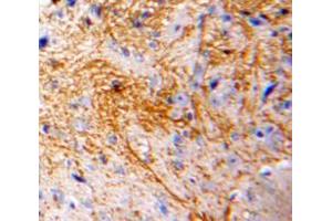 Used in DAB staining on fromalin fixed paraffin-embedded Brain tissue (CCL7 antibody  (AA 24-97))