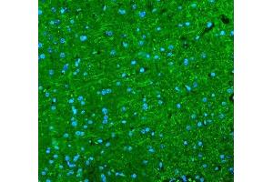 IF analysis of Alpha Internexin using anti-Alpha Internexin antibody (ABIN4886634). (INA antibody  (AA 71-161))