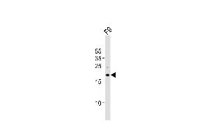 Western blot analysis of lysate from mouse F9 cell line, using (Mouse) Tdgf1 Antibody (N-term) (ABIN6243120 and ABIN6577808). (TDGF1 antibody  (N-Term))