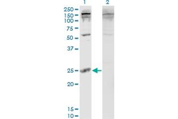 PDAP1 抗体  (AA 1-181)