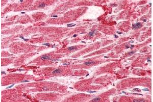 Human Heart (formalin-fixed, paraffin-embedded) stained with HES1 antibody ABIN307170 at 5 ug/ml followed by biotinylated goat anti-rabbit IgG secondary antibody ABIN481713, alkaline phosphatase-streptavidin and chromogen. (HES1 antibody  (AA 24-35))