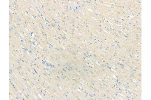 ABIN7094502 and ABIN7098551 at 1/100 staining Rat heart tissue by IHC-P. (Smoothelin antibody  (C-Term))
