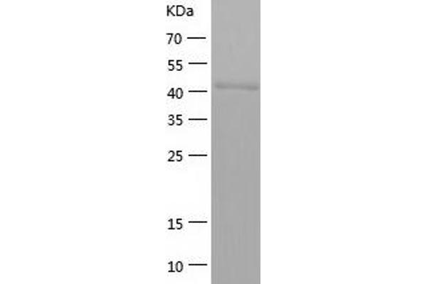 IDH1 Protein (AA 1-414) (His tag)