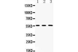 Western blot analysis of FGB expression in rat kidney extract ( Lane 1), mouse liver extract ( Lane 2) and HELA whole cell lysates ( Lane 3). (Fibrinogen beta Chain antibody  (Middle Region))