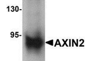 Western blot analysis of AXIN2 in mouse lung lysate with AXIN2 antibody at 1 μg/ml (AXIN2 antibody  (C-Term))