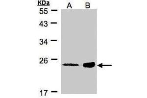 WB Image Sample(30 μg of whole cell lysate) A:MOLT4, B:Raji, 12% SDS PAGE antibody diluted at 1:500 (R-Ras antibody  (Center))