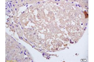 Immunohistochemistry (Paraffin-embedded Sections) (IHC (p)) image for anti-Coiled-Coil Domain Containing 11 (CCDC11) (AA 330-380) antibody (ABIN2172318)