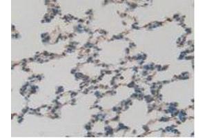 IHC-P analysis of Rat Lung Tissue, with DAB staining. (GATA4 antibody  (AA 228-440))
