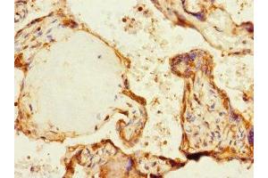Immunohistochemistry of paraffin-embedded human placenta tissue using ABIN7169067 at dilution of 1:100 (MARK1 antibody  (AA 560-700))