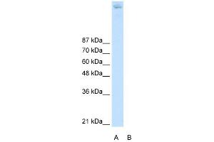 ZBTB38 antibody (20R-1249) used at 0. (ZBTB38 antibody  (N-Term))