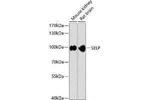 Western blot analysis of extracts of various cell lines using SELP Polyclonal Antibody at dilution of 1:1000. (P-Selectin antibody)