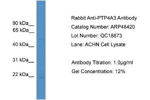 WB Suggested Anti-PTP4A3  Antibody Titration: 0.