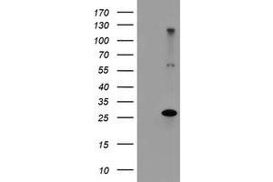 Image no. 1 for anti-Regulatory Factor X-Associated Ankyrin Containing Protein (RFXANK) antibody (ABIN1500684) (RFXANK antibody)
