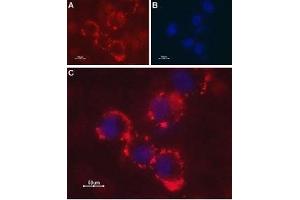 Expression of Latrophilin-1 receptor in SH-SY5Y cell line - Cell surface detection of Latrophilin-1 receptor in intact living human neuroblastoma (SH-SY5Y) cells. (Latrophilin 1 antibody  (Extracellular, N-Term))