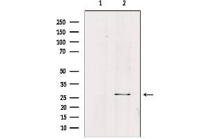 Western blot analysis of extracts from HepG2, using FGF23 Antibody.