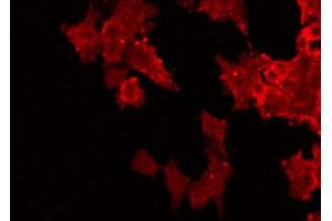 ABIN6272530 staining HuvEc by IF/ICC. (UL97 antibody)