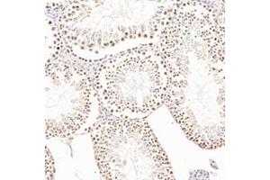 Immunohistochemistry analysis of paraffin-embedded rat testis using,AF10 (ABIN7075234) at dilution of 1: 1200 (MLLT10 antibody)