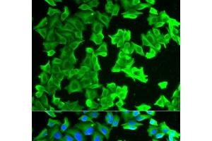 Immunofluorescence analysis of HeLa cells using RPLP0 Polyclonal Antibody