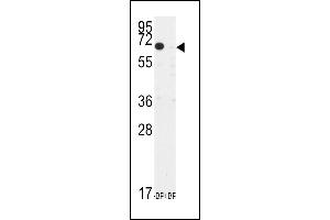 Western blot analysis of anti-TIEG Antibody (N-term) (ABIN392159 and ABIN2841880) pre-incubated with and without blocking peptide in CEM cell line lysate. (KLF10/TIEG1 antibody  (N-Term))