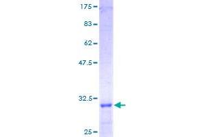 Laminin gamma 1 Protein (AA 1-38) (GST tag)