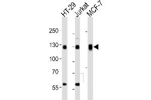 Western blot analysis of lysates from HT-29, Jurkat, MCF-7 cell line (from left to right), using SMG7 Antibody (C-term) (ABIN6244188 and ABIN6577686).