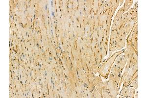 ABIN6265986 and ABIN6268668 at 1/100 staining Mouse heart tissue by IHC-P.