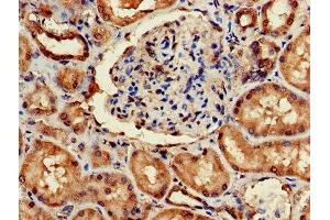Immunohistochemistry of paraffin-embedded human kidney tissue using ABIN7143447 at dilution of 1:100 (ARF4 antibody  (AA 1-180))