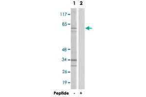 Western blot analysis of extracts from HepG2 cells, using DDX51 polyclonal antibody .