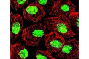 Fluorescent confocal image of U251 cell stained with NCL antibody at 1:25. (Nucleolin antibody  (AA 276-304))