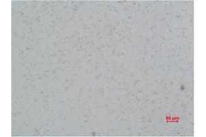 Immunohistochemistry (IHC) analysis of paraffin-embedded Rat Brain Tissue using L-type Ca++ CP gamma5 Polyclonal Antibody. (L-Type Ca++ CP Gamma5 antibody)