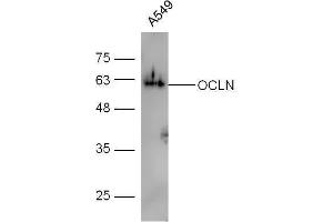 Human A549 lysates probed with Rabbit Anti-Occludin Polyclonal Antibody, Unconjugated  at 1:5000 for 90 min at 37˚C. (Occludin antibody  (AA 431-522))
