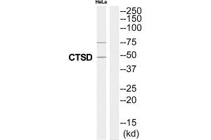 Western Blotting (WB) image for anti-Cathepsin D (CTSD) (Internal Region) antibody (ABIN1852782) (Cathepsin D antibody  (Internal Region))