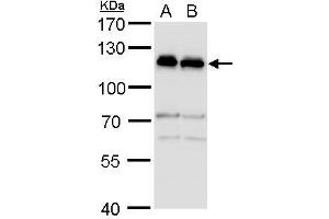 WB Image alpha Adducin antibody detects alpha Adducin protein by western blot analysis. (alpha Adducin antibody)