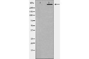 Western blot analysis of DNA PK expression in K562 cells.