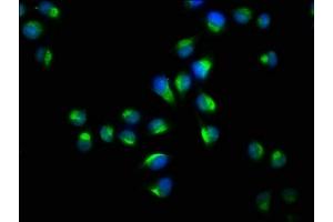 Immunofluorescence staining of Hela cells with ABIN7142103 at 1:73, counter-stained with DAPI.