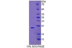 SDS-PAGE analysis of Human RalA Binding Protein 1 Protein.